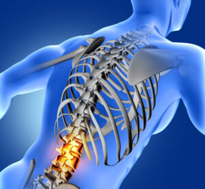 Spinal Cord Stimulation