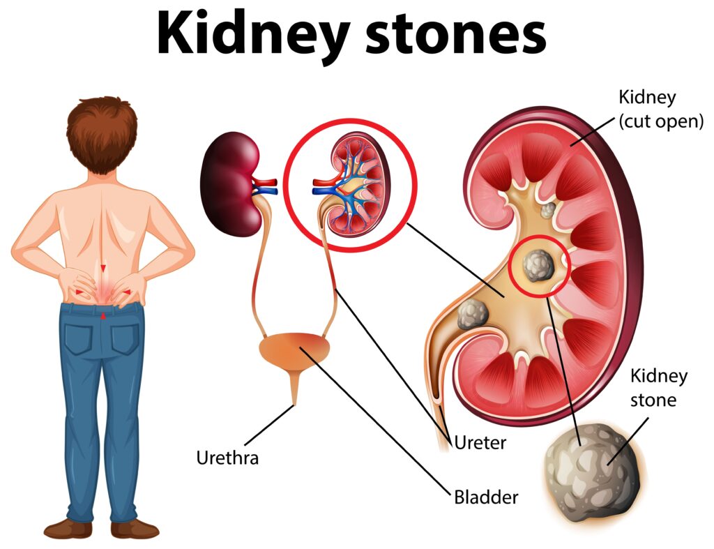 What Diseases Can Be Detected by Ultrasound?-Primary Care of Kansas