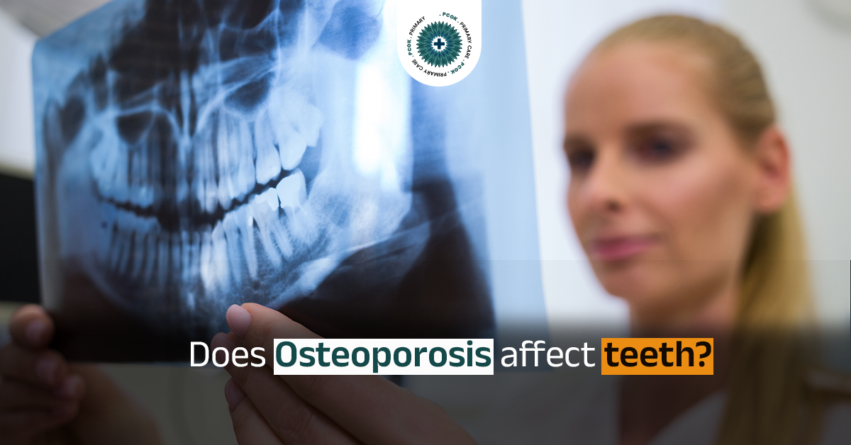 Does Osteoporosis Affect Your Teeth