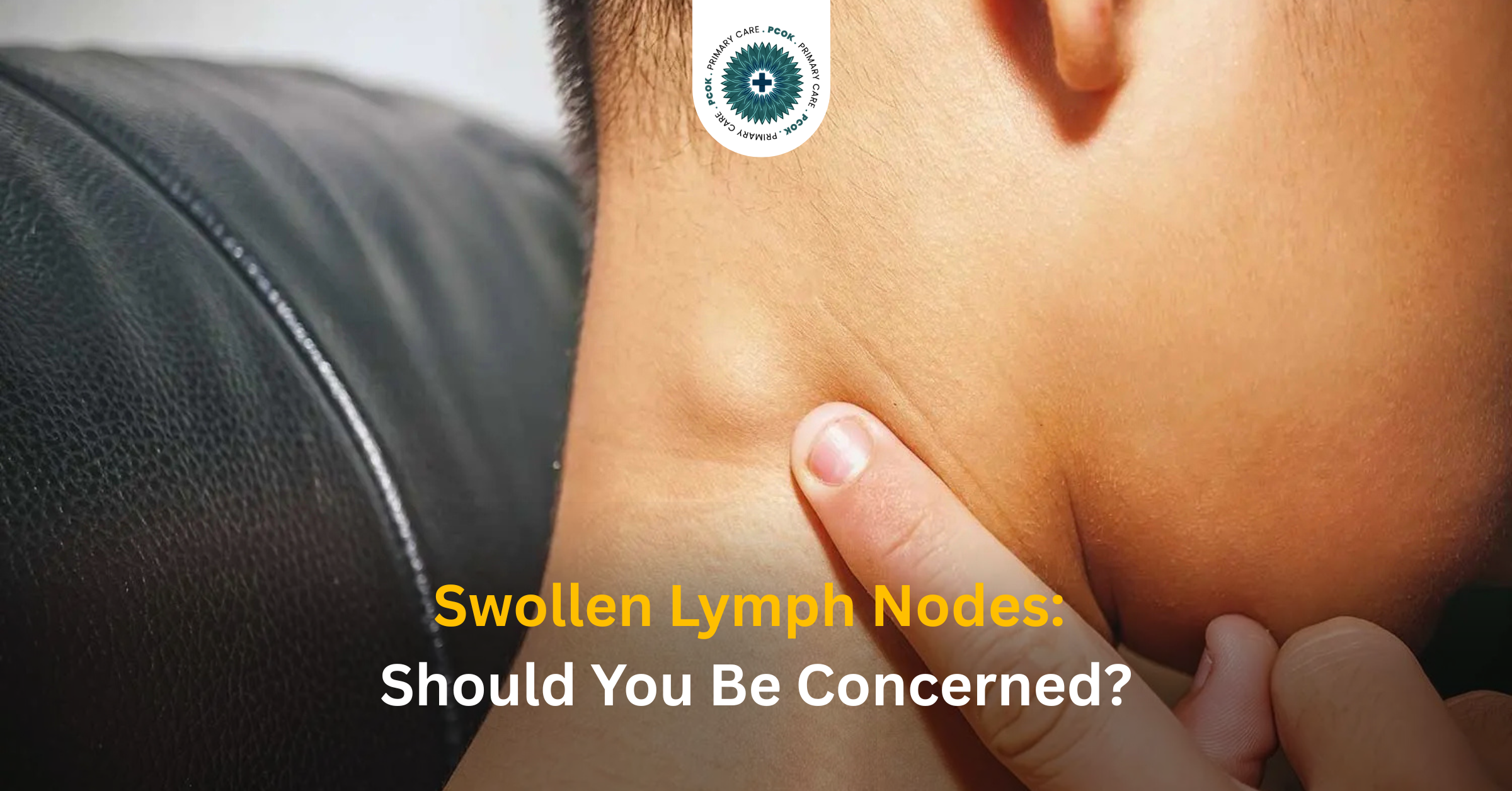 Swollen Lymph Nodes