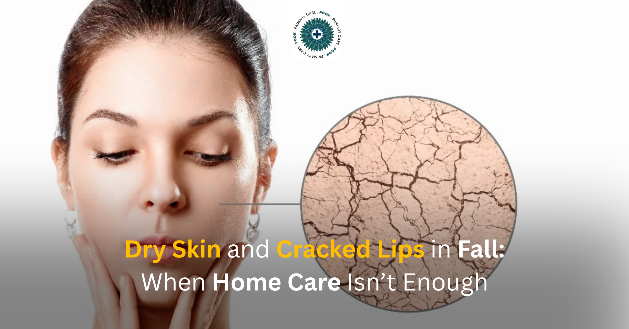 Dry Skin